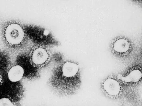 Covid-19: País europeu bate recorde de casos de infectados