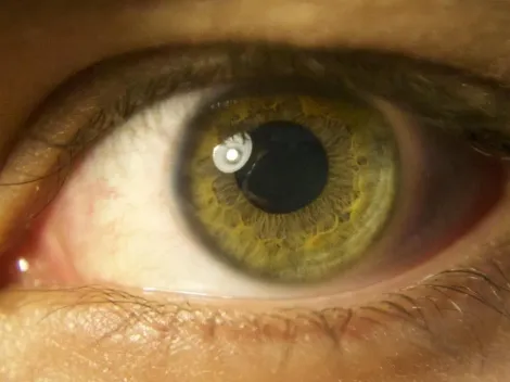 Estudo revela que mesmo após a morte, a retina dos olhos apresenta alguns sinais