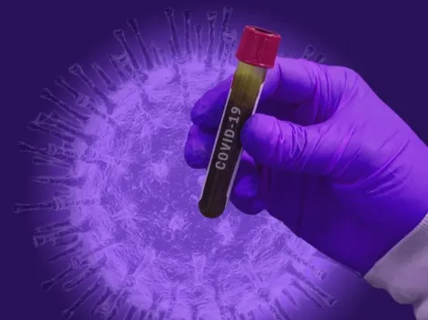 Covid-19: Número de casos sobe 262% no Brasil em duas semanas