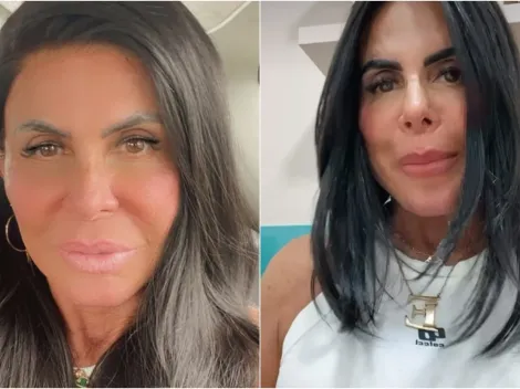 Gretchen faz cirurgia para a retirada do útero