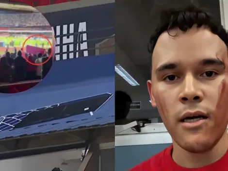 Veja momento em que placa despenca na cabeça de torcedor do São Paulo