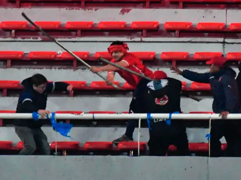 Jugador de Coquimbo Unido solidariza con la U