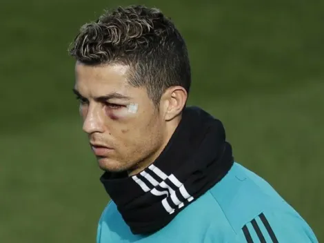 Cristiano tiene el ojo en compota y no jugará ante Leganés