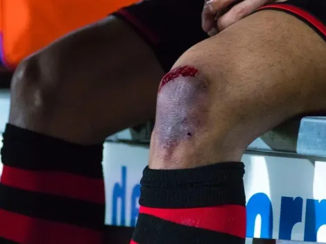 Impresionante: Así le quedó la rodilla a Bou