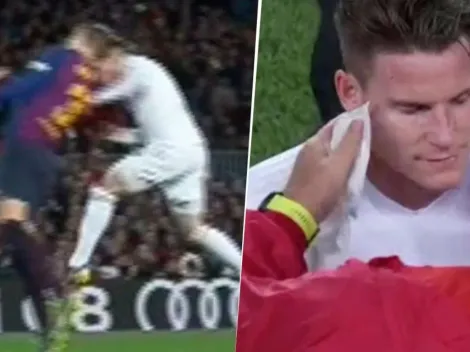 Parece maquillado: así le quedó la cara a Gameiro después de su choque con Piqué