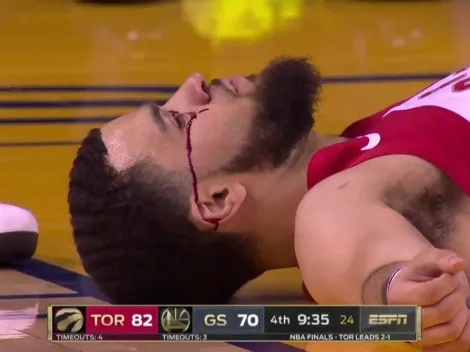 ¡Ouch! Le rompieron la cara a VanVleet con un terrible codazo en las Finales