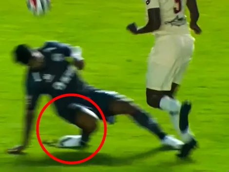 Lo lamenta Melgar: Paolo Reyna sufrió terrorífica lesión