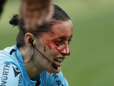 Insólito: el accidente que sacó del partido a una asistente en LaLiga