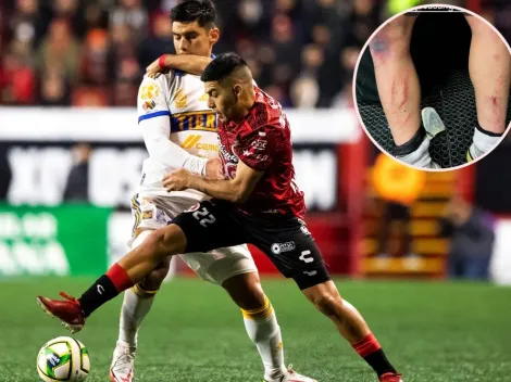 Así quedaron las piernas de Jesús Angulo tras el Xolos vs Tigres UANL