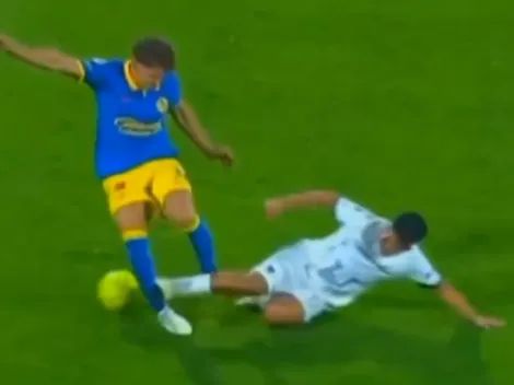 Así quedó la pierna de Lichnovsky tras la patada de Quispe