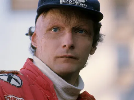 Así era el rostro de Niki Lauda antes de sus graves quemaduras