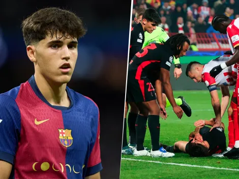 ¡Impresionante! Así quedó Pau Cubarsí tras su corte en la cara en la UEFA Champions League