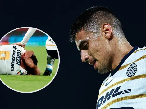 ¿Expone al arbitraje? Así quedó la herida de 'Memo' Martínez tras la patada en Pumas - Toluca