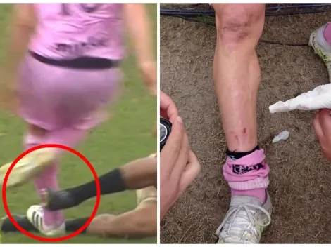 El terrible cruce entre Leonardo Rugel y Sebastián Penco que pudo terminar en una desgracia