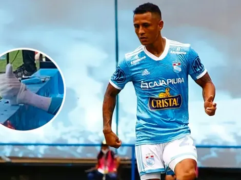 ¿Yoshimar Yotún, lesionado? La razón por la que le pusieron hielo