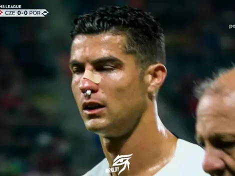 ¡Lleno de sangre! Así quedó el rostro de Cristiano tras fuerte choque