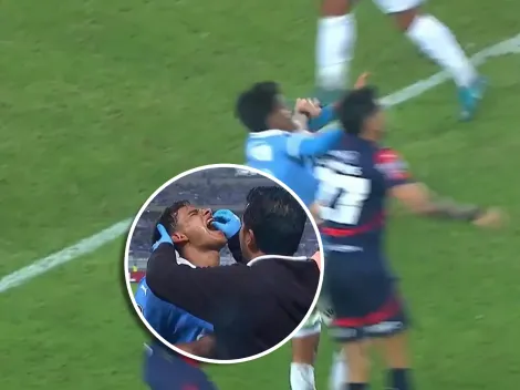 Así le quedó la boca sin un diente a Jhilmar Lora tras el tremendo codazo que recibió ante Cerro Porteño