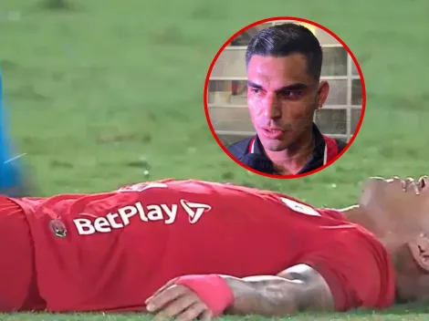 Luis Ramos revela que vivió momentos de terror tras sufrir golpe en la cabeza