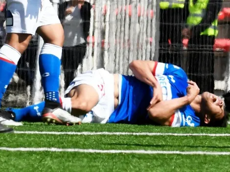 Video: La dolorosa fractura que sufre Francisco Silva en Copa Chile