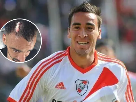 El ex River que vivió un calvario en el Federal A: herido por un piedrazo y "nos robaron el partido"