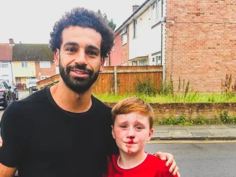 Salah cumple el sueño de un niño que se rompió la nariz siguiéndolo