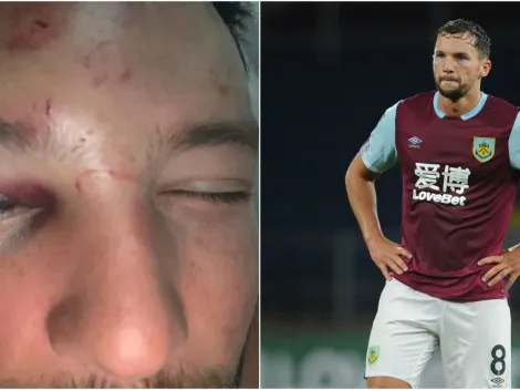Matones le dan feroz paliza a Drinkwater
