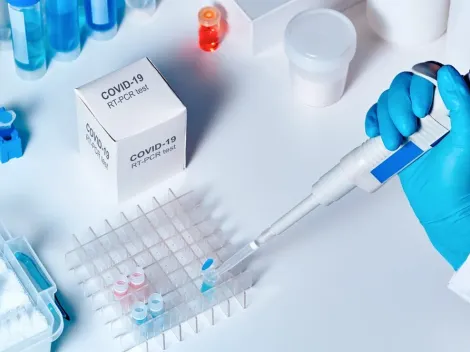 Ministerio de Salud asegura que hay test de PCR suficientes para la red pública