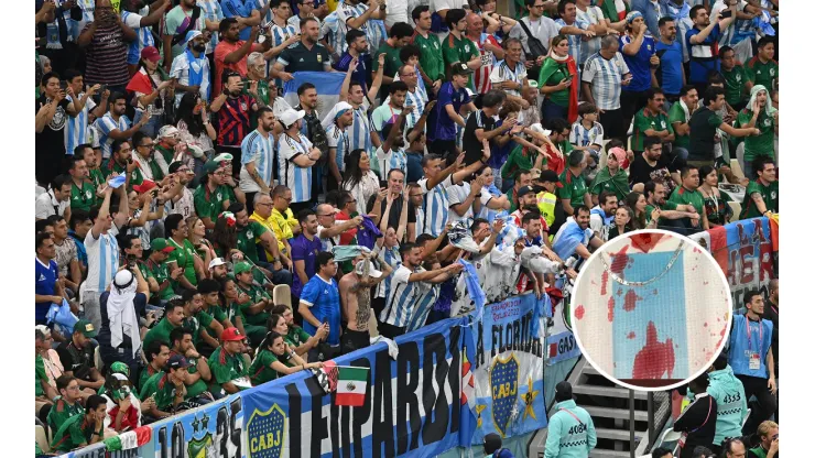 Impactante: un hincha argentino mostró cómo le quedó la cara tras la pelea con los mexicanos