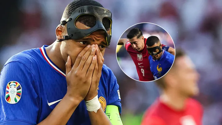 Mbappé recibió un golpe en la cara y asustó a Francia
