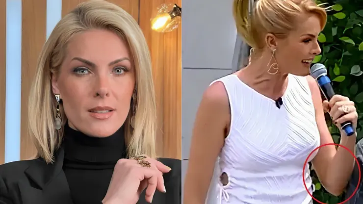 Ana Hickmann aparece com hematoma no braço. Foto: Reprodução/Instagram - Ana Hickmann (Imagem 1) / Reprodução/Record (Imagem 2)
