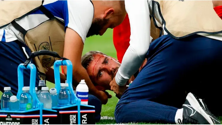 El atacante francés recibió una brutal patada en el duelo que tuvo su selección ante Grecia.
