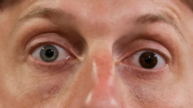 Max Scherzer eyes
