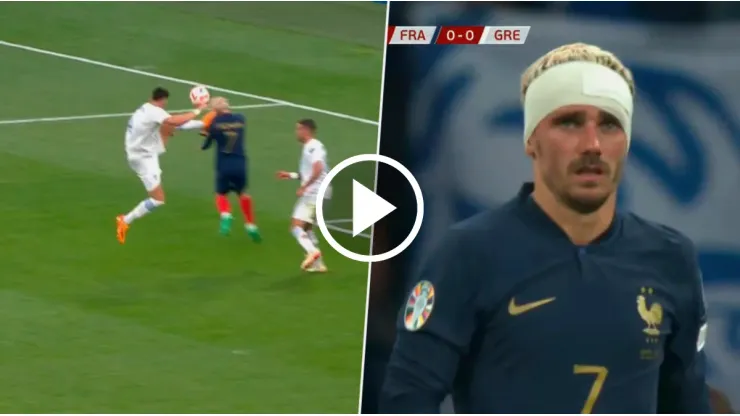 VIDEO | Casi le arrancan la oreja a Griezmann con violenta patada