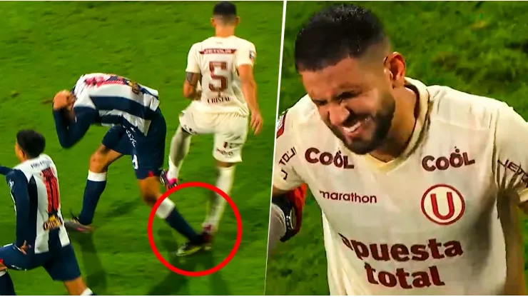 Lo sufre Universitario: el momento exacto en que Di Benedetto se lesionó