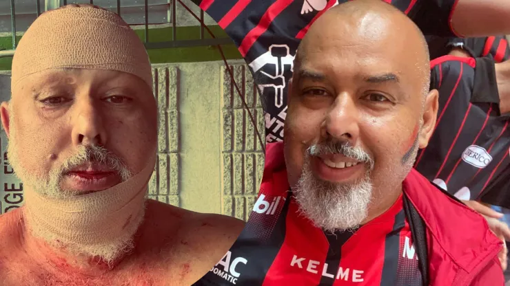 “Me querían matar”: aficionado de Alajuelense detalla la barbarie sufrida en Comunicaciones