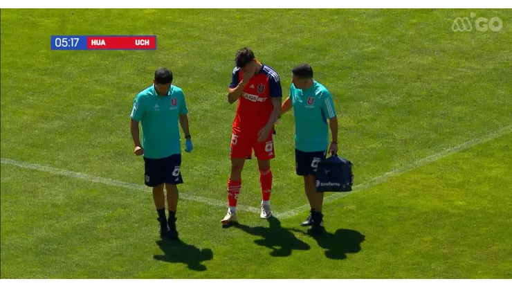 Juan Pablo Gómez salió lesionado del amistoso entre la U y Huachipato. 