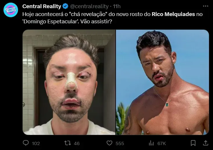 Antes e depois de Rico Melquiades: influenciador revela novo rosto