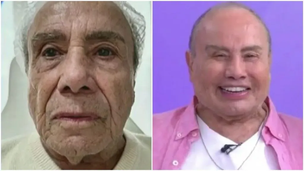 Stênio Garcia antes e depois do procedimento – Foto: SBT