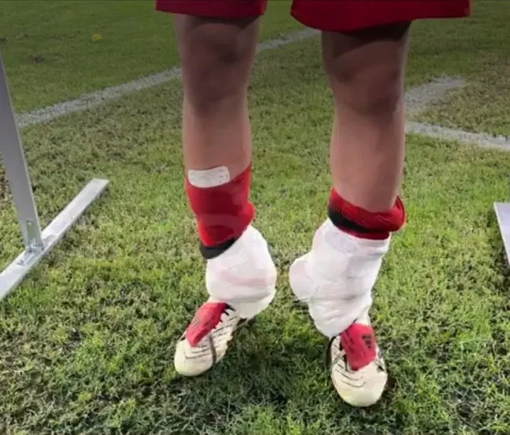 Así terminó Mastantuono el partido en Guayaquil. (Foto: @SC_ESPN).