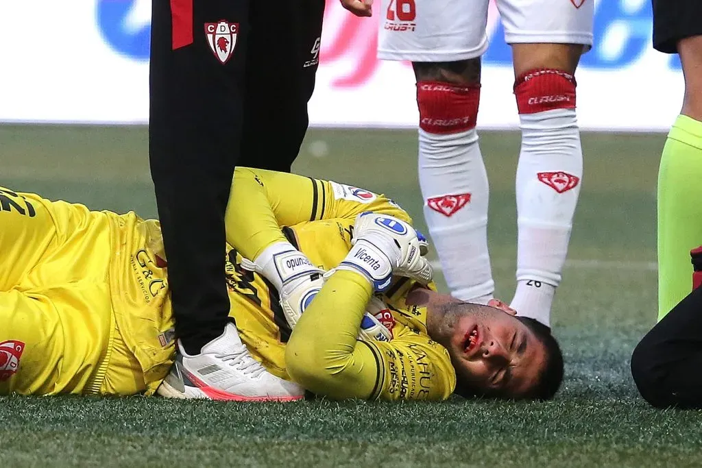 Así terminó Nelson Espinoza tras el choque con Fernando Zampedri, quien ni siquiera vio la tarjeta amarilla. Foto: Photosport.