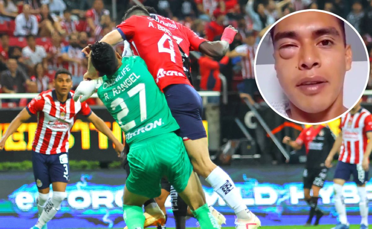 Chivas: Así quedó el rostro del Tala Rangel tras su lesión ante Atlas ...