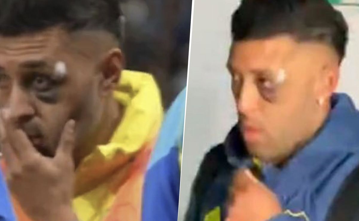 Viral: por qué Lucas Janson apareció con el OJO LASTIMADO en el partido entre Boca y Racing
