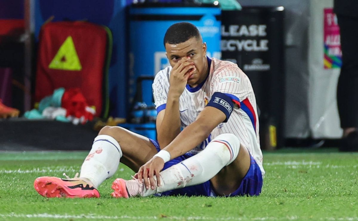 France has hurdle as Mbappe misses games for a broken nose