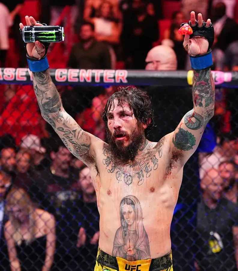 Chiro Vera quedó muy golpeado tras la pelea contra Sean O’Malley. Foto: Getty.