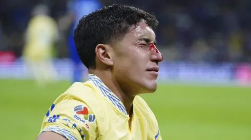 Zendejas sufrió una fractura de nariz contra Monterrey.
