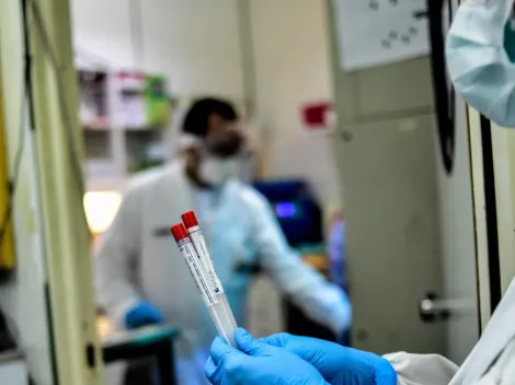 Coronavirus HOY: cuántos casos de COVID-19 fueron confirmados este martes 17 de agosto en Argentina