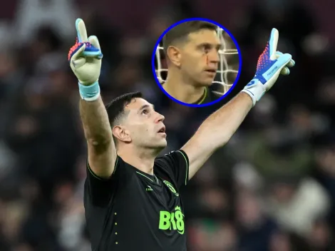 Terminó hasta con un corte en el pómulo: sobrio partido de Dibu Martínez ante Arsenal