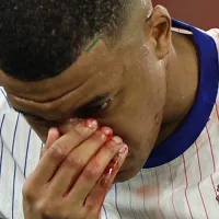 No apto para sensibles: así quedó la nariz de Mbappé tras el golpe en la cara que sufrió en el Francia vs. Austria