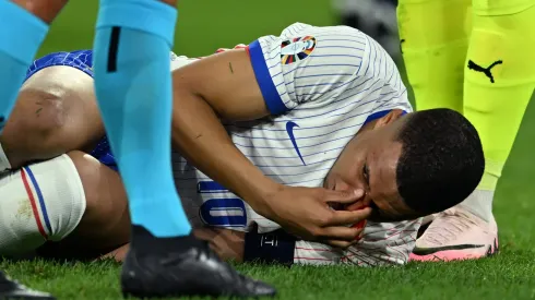 Así quedó Kylian Mbappé después del golpe.