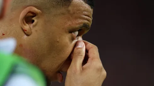 Mbappé no pudo terminar el partido ante Austria.